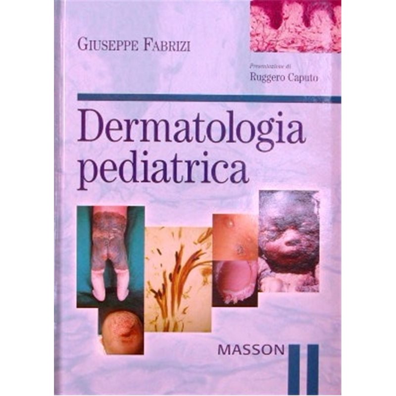 Dermatologia pediatrica